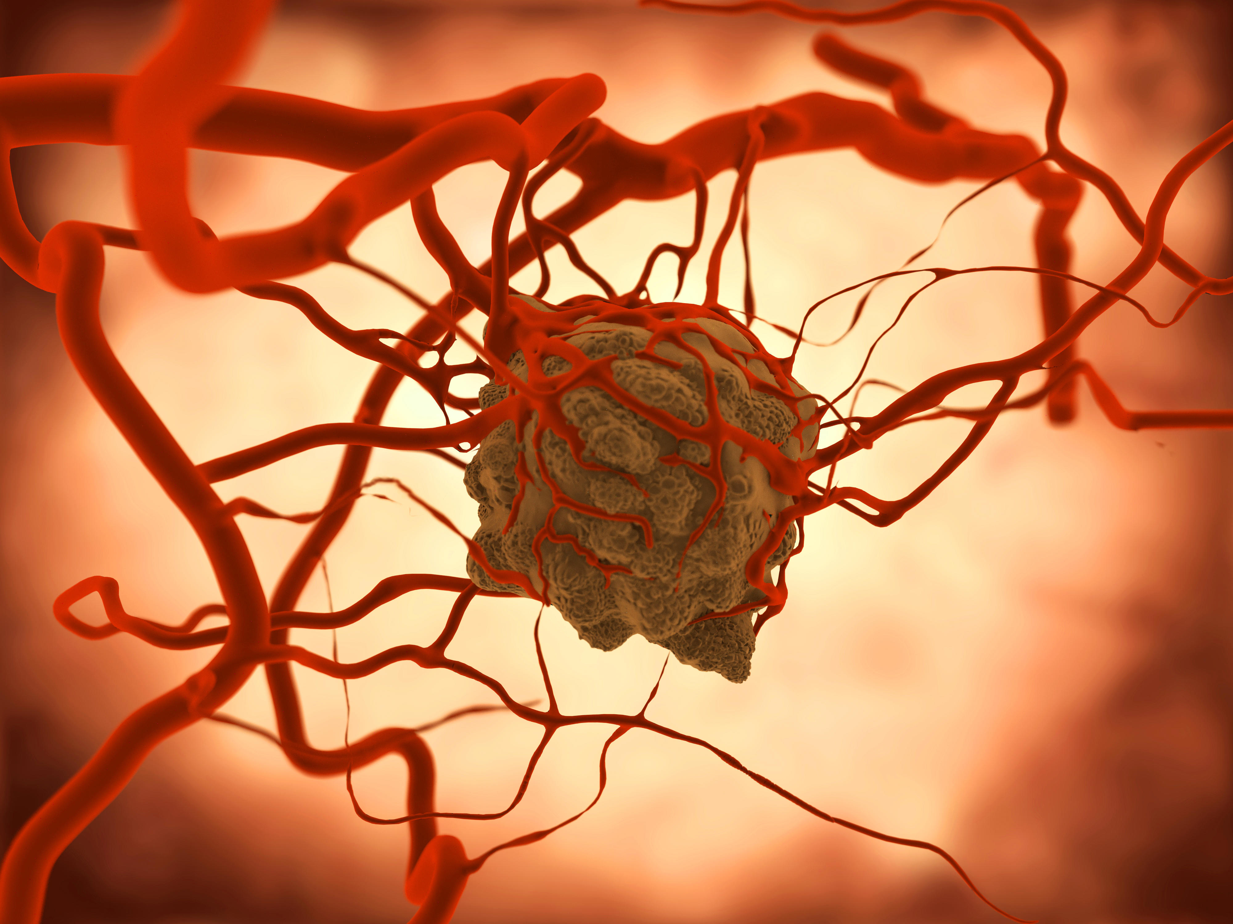 oncology