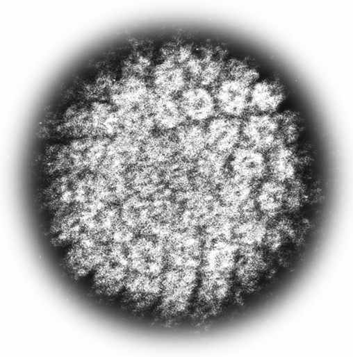 HPV（ヒトパピローマウイルス）画像