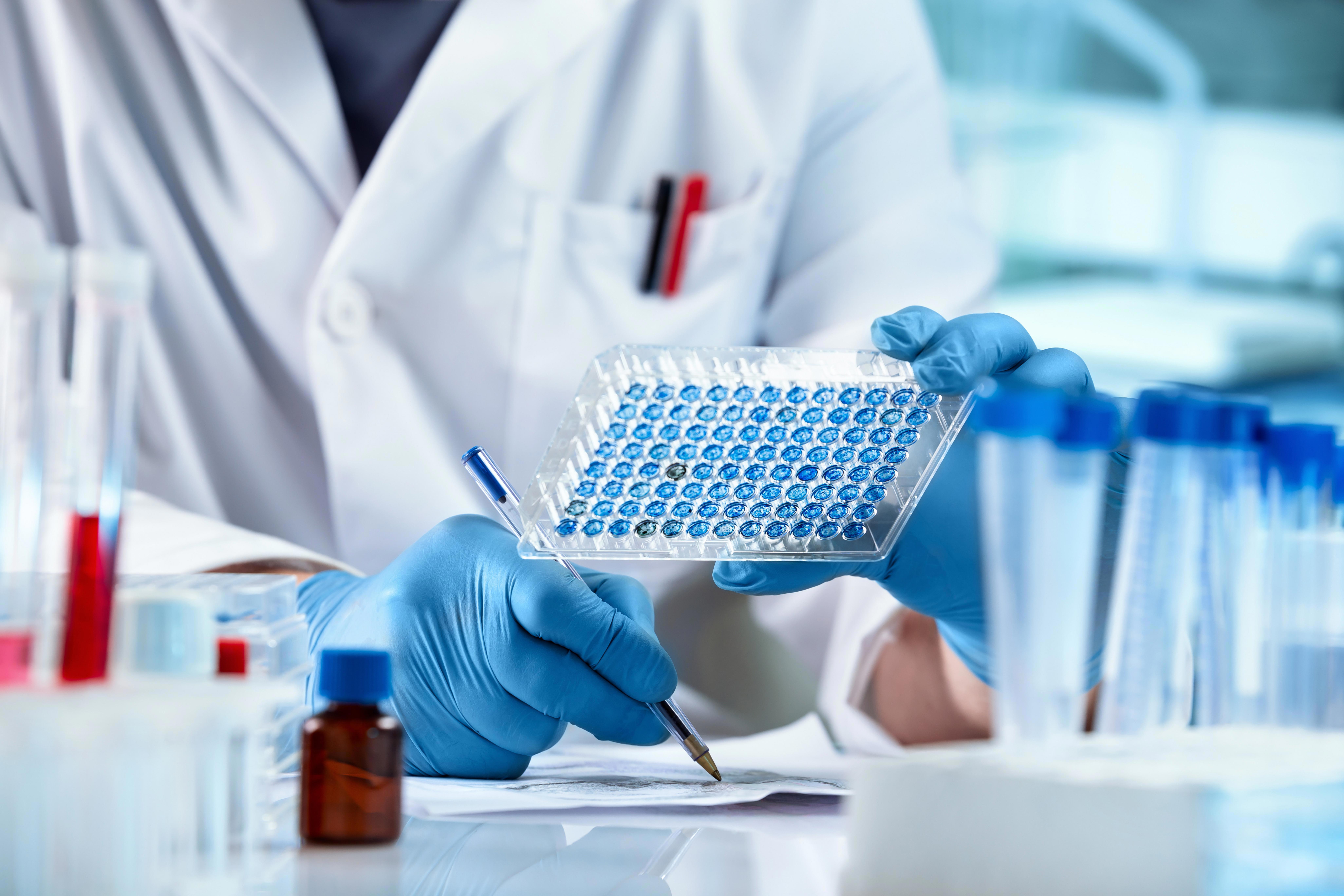 scientist-working-with-samples-panel-microplate-and-registering-data-for-diseases-diagnostic-in-the-laboratory_8208x5472px
