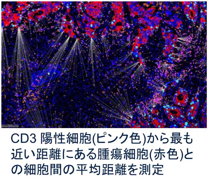 CD3 陽性細胞(ピンク色)から最も近い距離にある腫瘍細胞(赤色)との細胞間の平均距離を測定