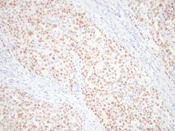 c056b