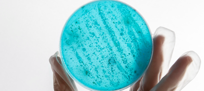 agro-petridish-hand800x357