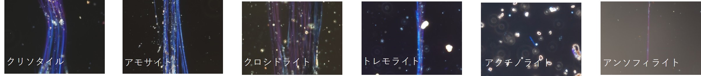 分散染色法による観察例