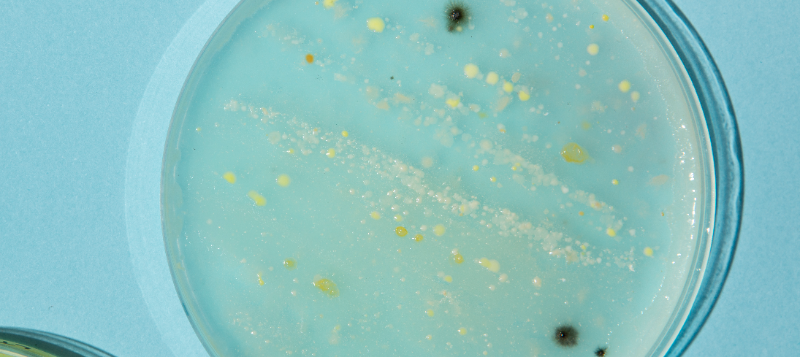 agro-petridish22-800x357-blue-green-bacteria