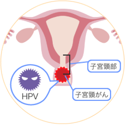 図_HPVイメージ