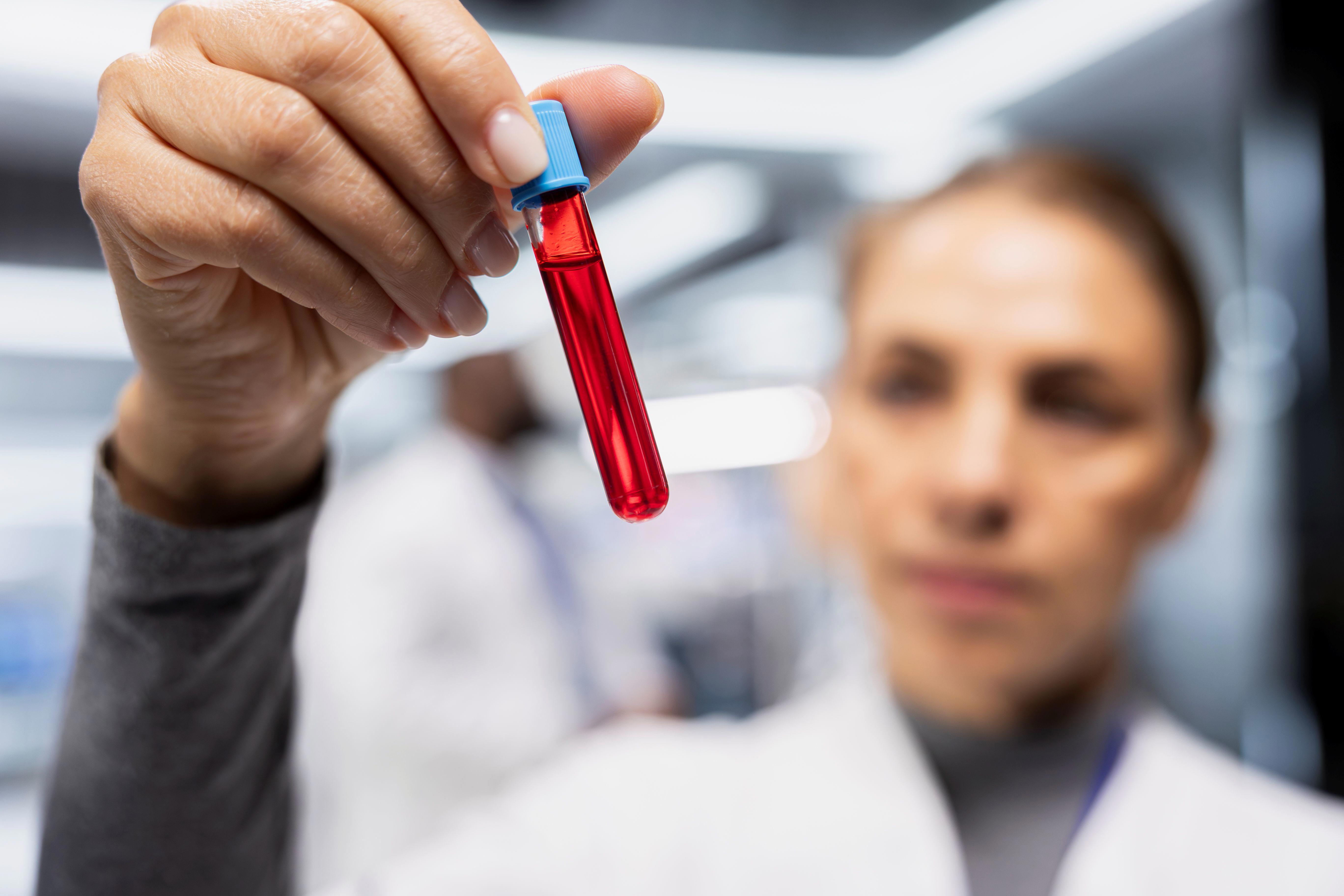 woman-scientist-collecting-checking-blood-test-tubes-drug-test-doing-medical-study
