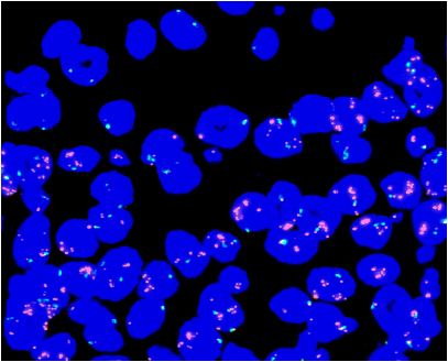 Tissue FISH Egfr
