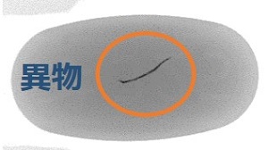 異物分析事例