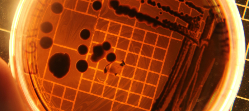 agro-bacteria-dark-petridish-800x357