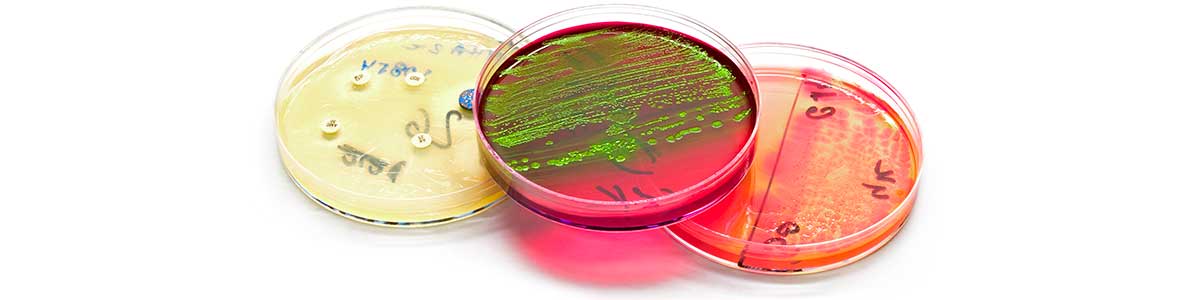 petri_dishes