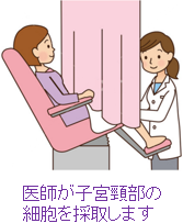 子宮頸部細胞の採取風景