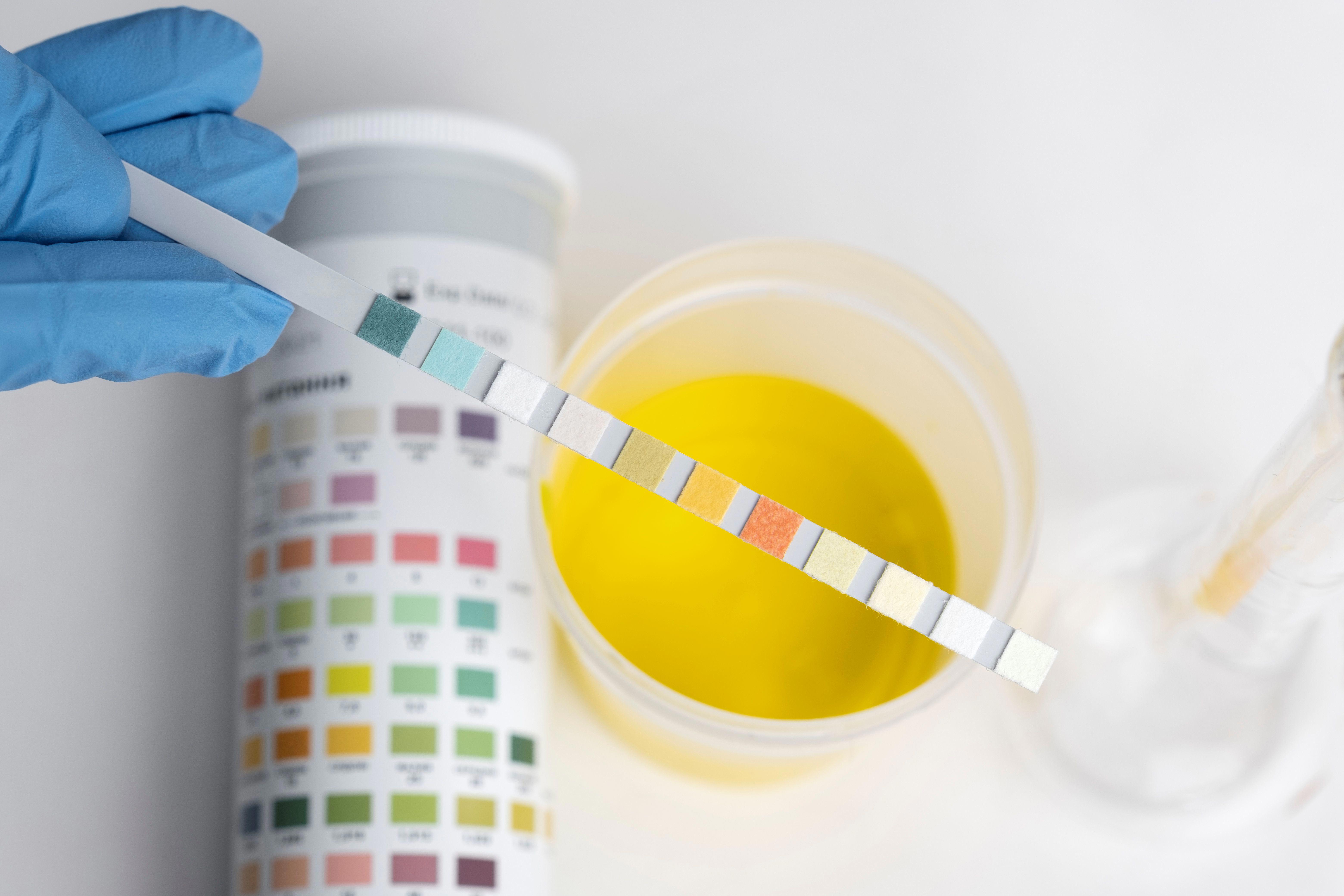 lab-doctor-performing-medical-exam-urine