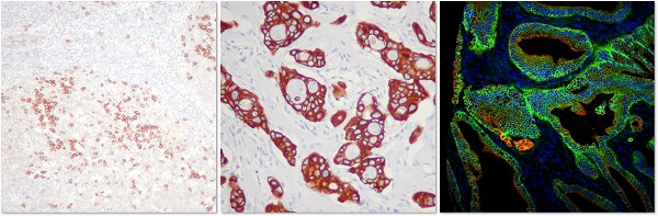 免疫染色(IHC)