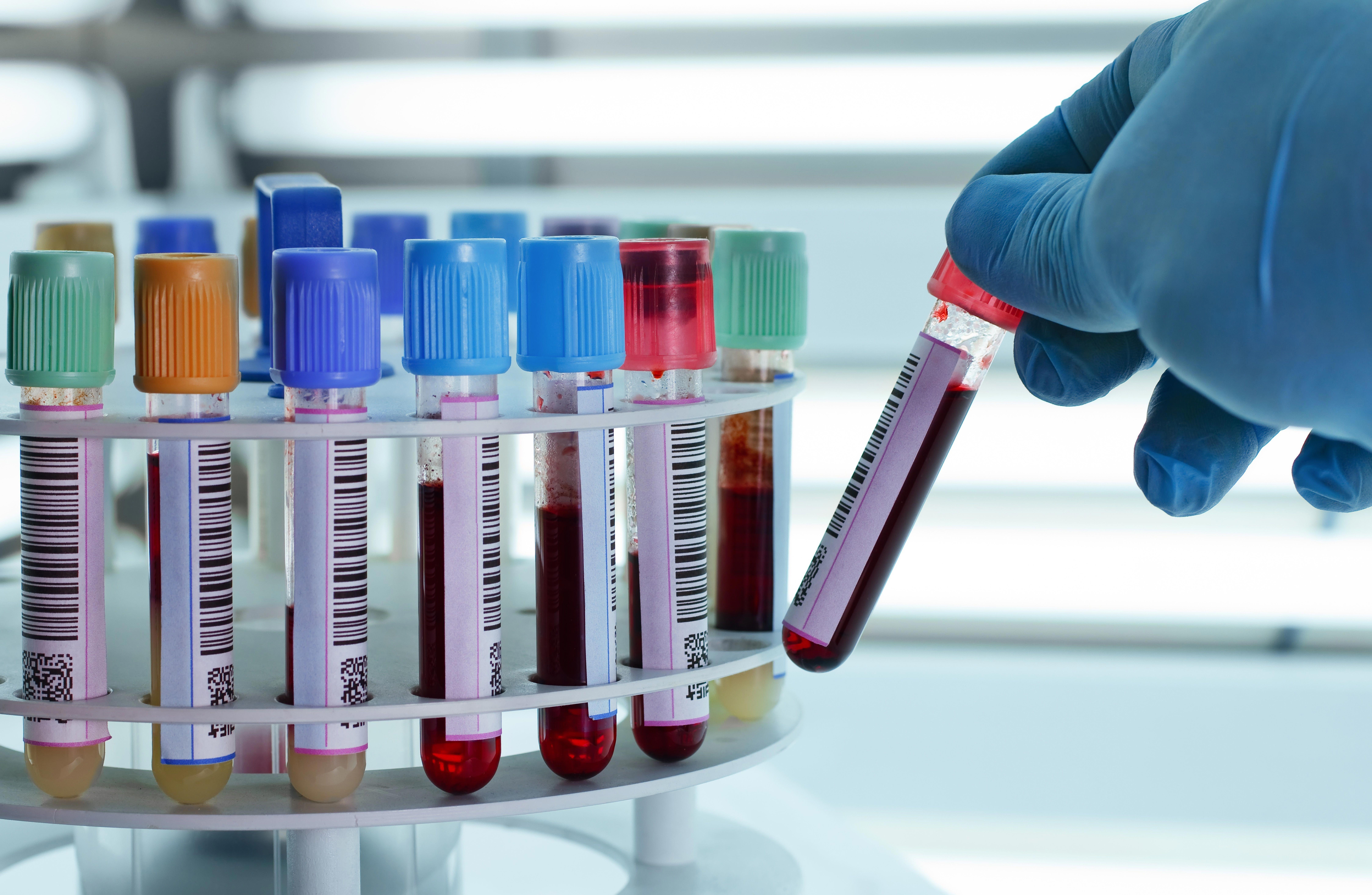 technician-placing-blood-tubes-in-the-laboratory-centrifuge_8991-x-5862-px