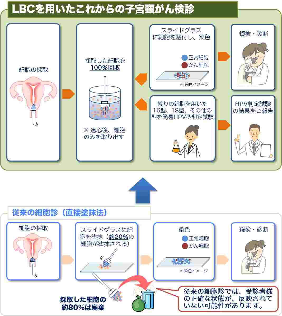 LBCを用いるメリット