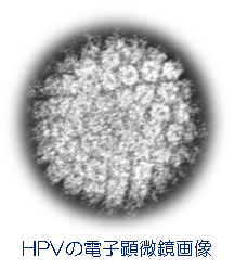 HPVの電子顕微鏡画像