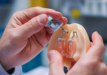 Close-up of a person’s hands holding a medical device prototype with transparent and metallic components, illustrating MDS Consulting’s focus on precision and control in medical device design.