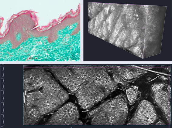 spicules-in-cosmetics