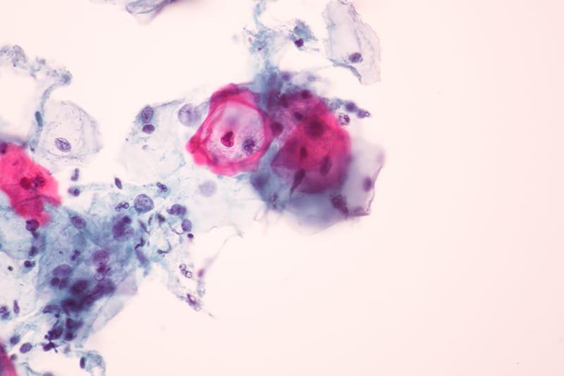 pap-smear