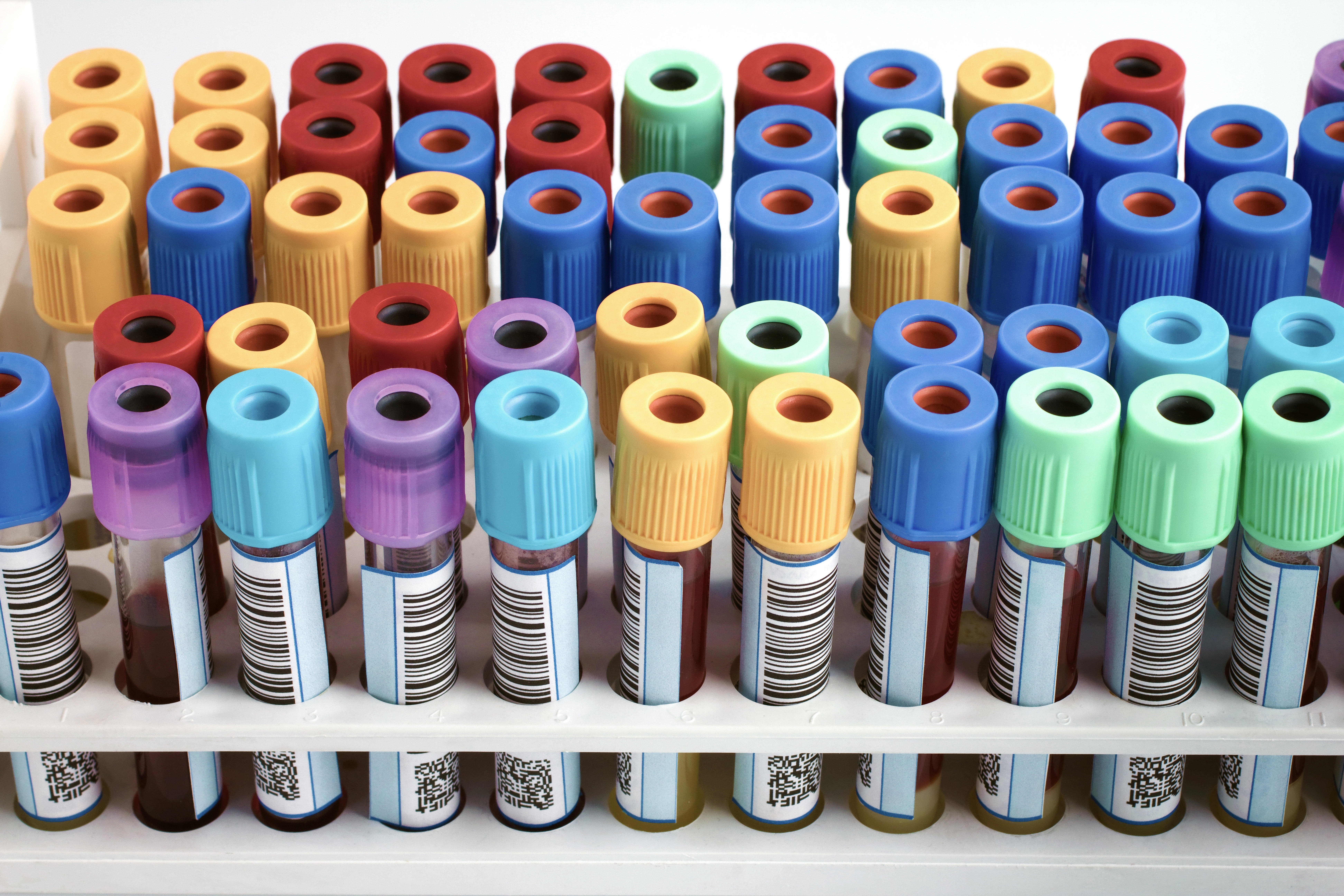 rack-of-blood-tubes-labeled-in-blood-bank-lab_7776-x-5184-px