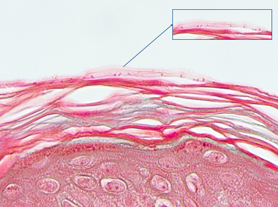 nl_feb26_skin-colonisation