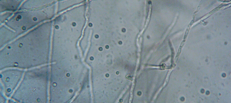 hyphae800x357