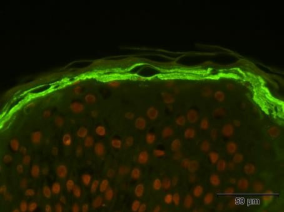 nl_jan25_atoderm-skin