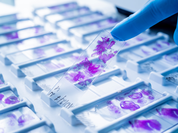 ecl-pathology-case-study-thumbnail-1