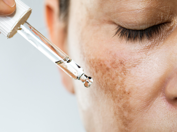 nl_oct25_pre-post-treatment