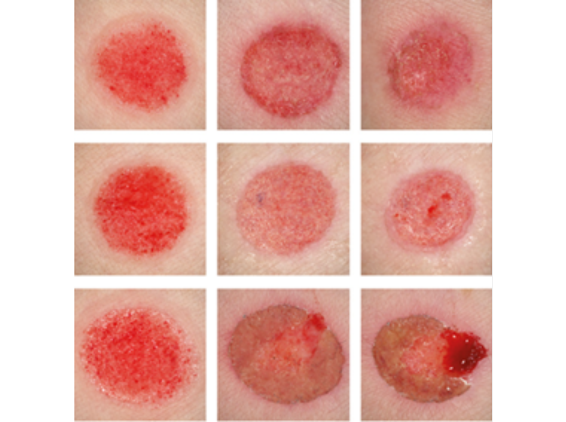 nl_jan25_tissue-regeneration