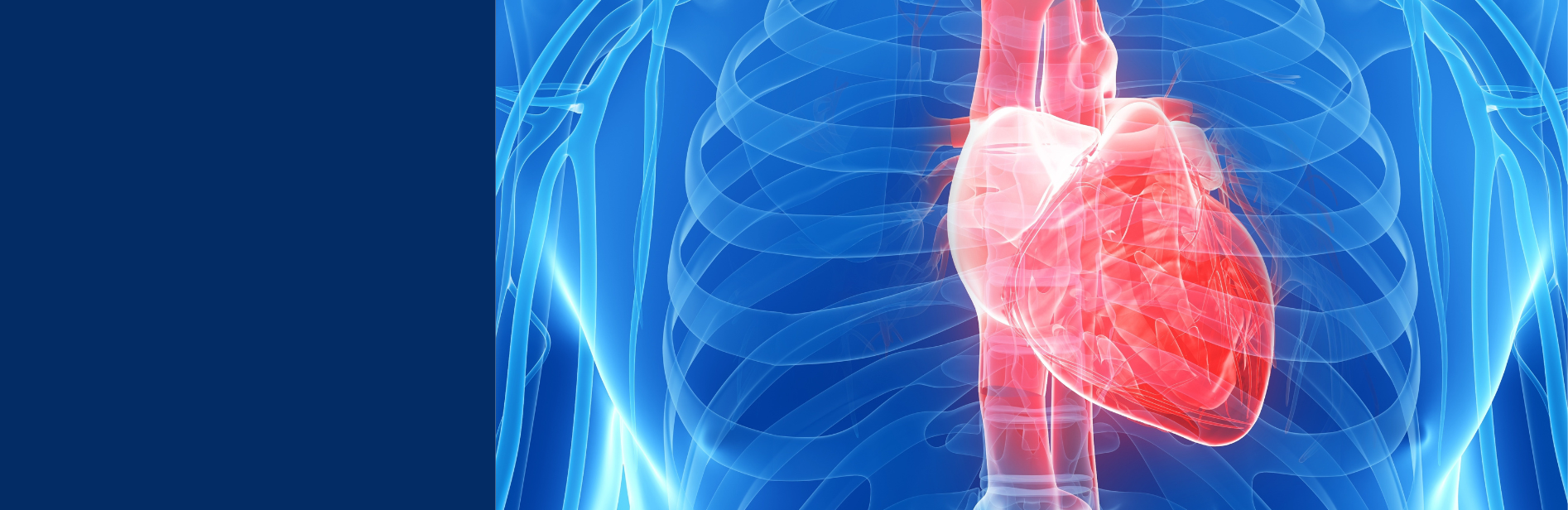 card-heart-transplant