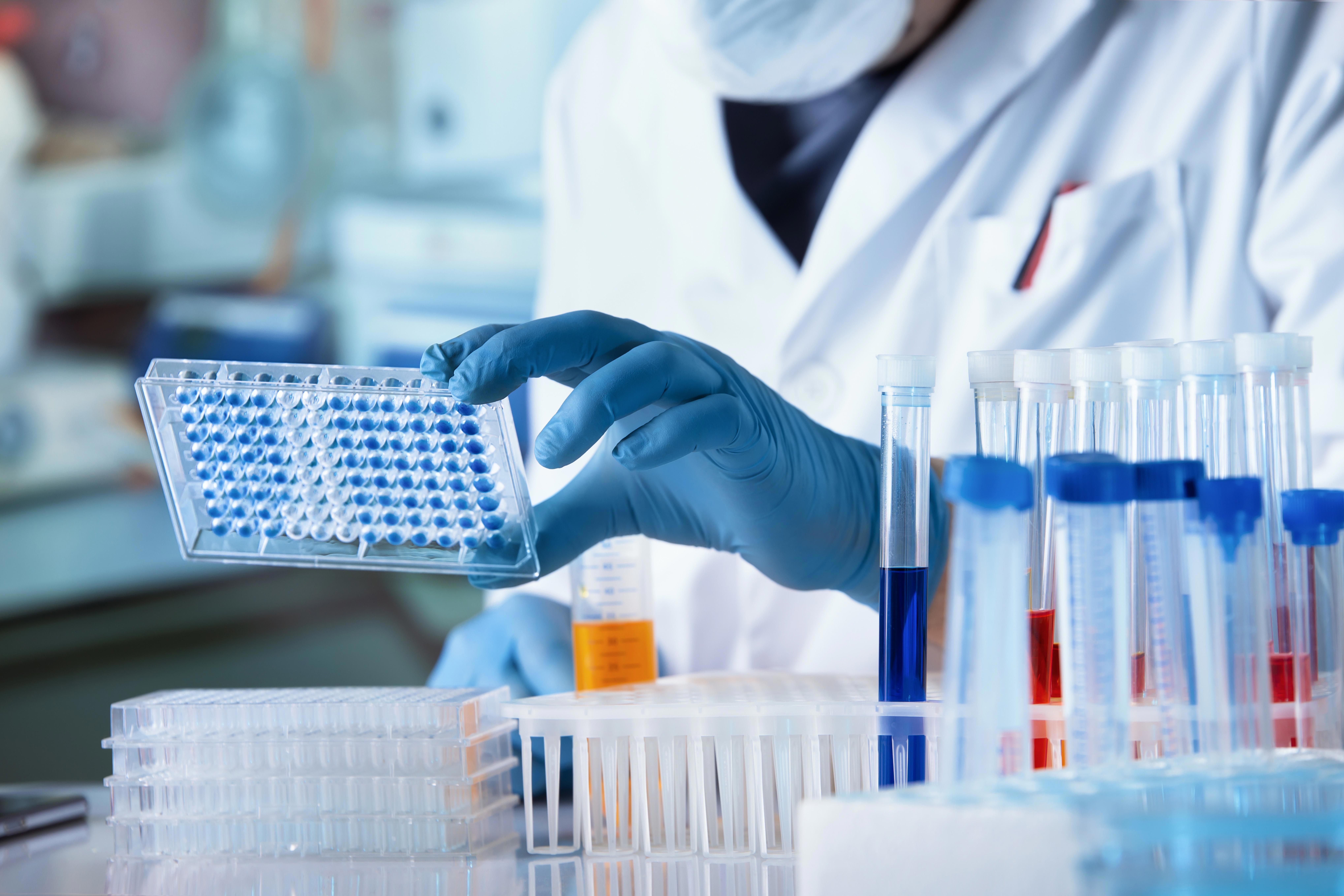 researcher-working-with-microplate-panel-for-diseases-diagnosis-in-the-laboratory_8151-x-5433-px