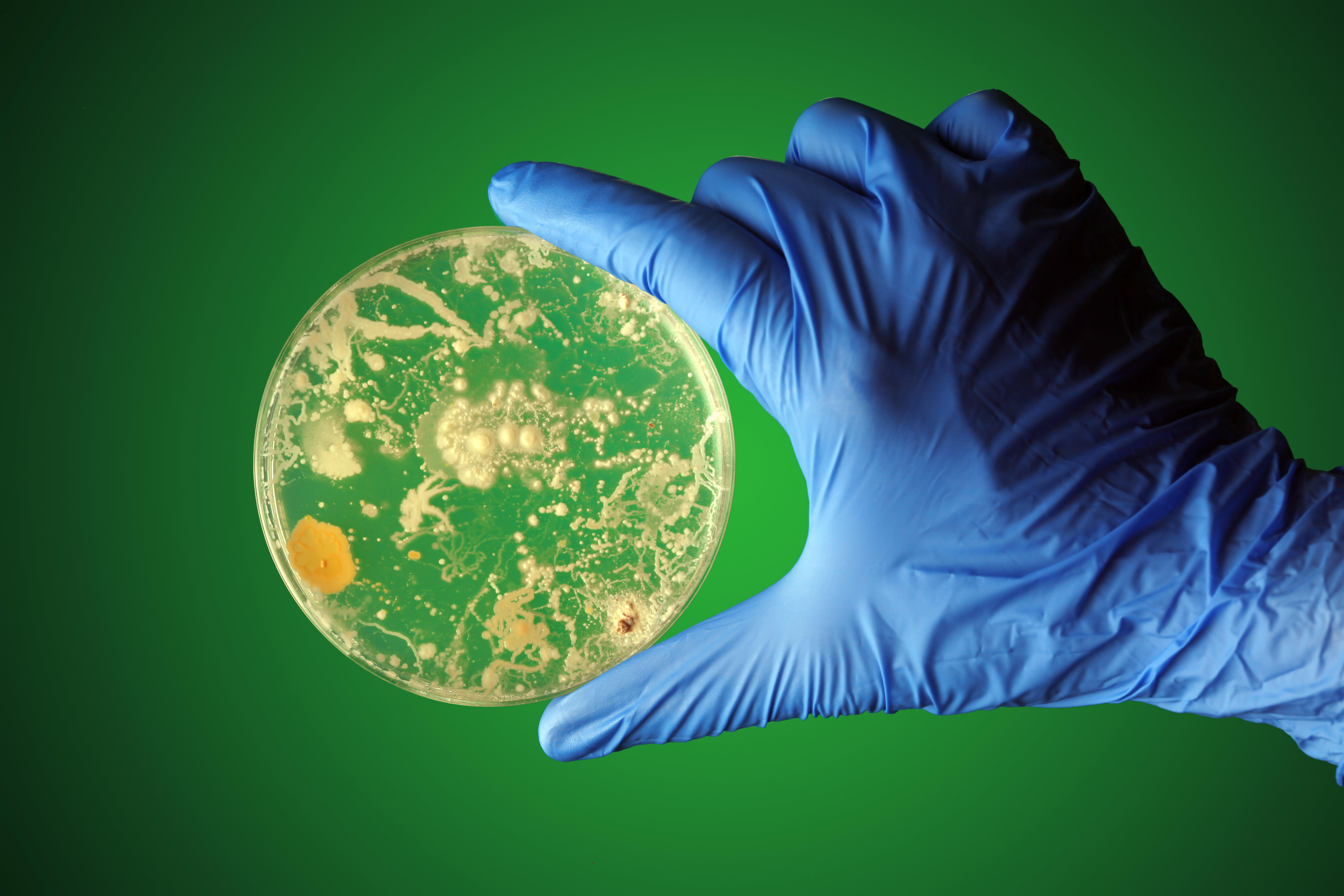 gloved-hand-holding-bacteria-growing-in-a-petri-dish_8424-x-5616-px