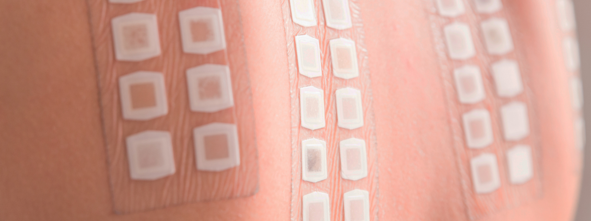 industry-solutions-sensitive-skin-hript