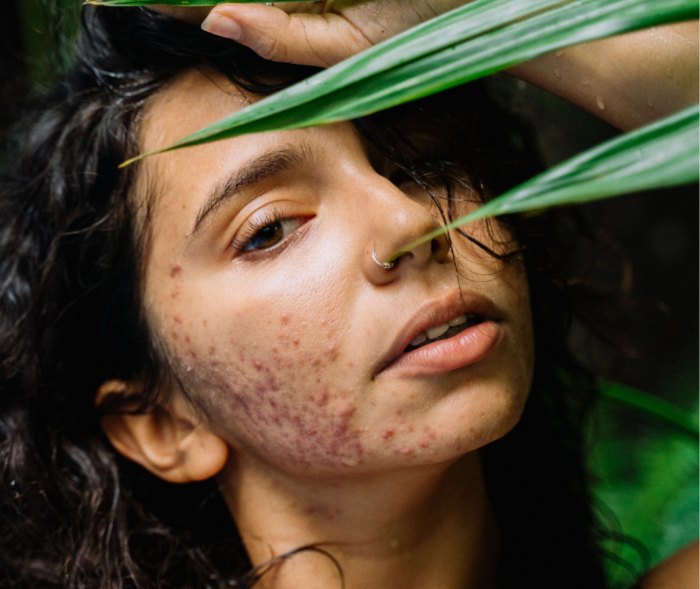 problemsolution-cosmeceuticals