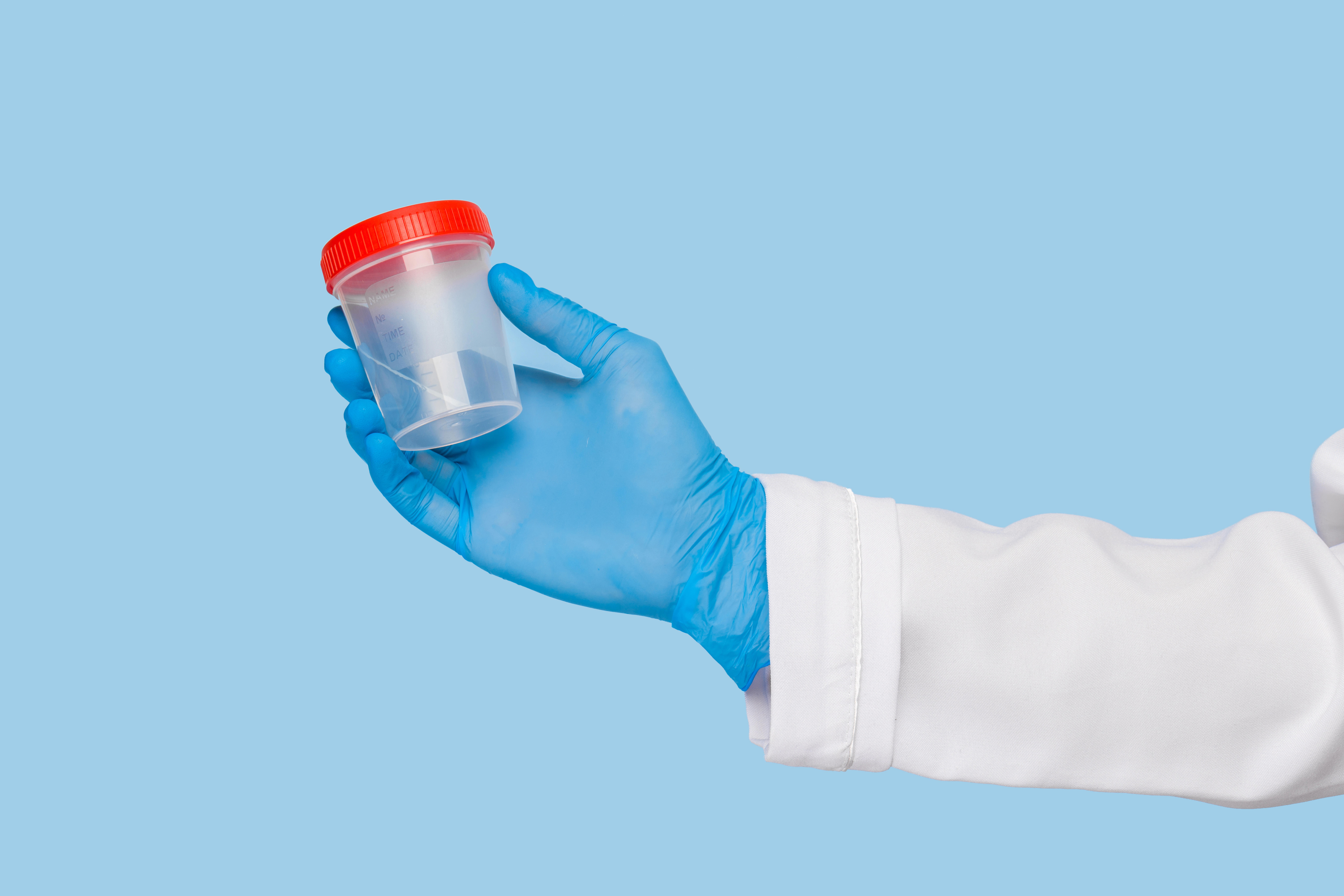 hands-of-a-doctor-in-sterile-gloves-hold-a-jar-for-analysis-of-urine-or-feces-on-a-blue-background_8208-x-5472-px