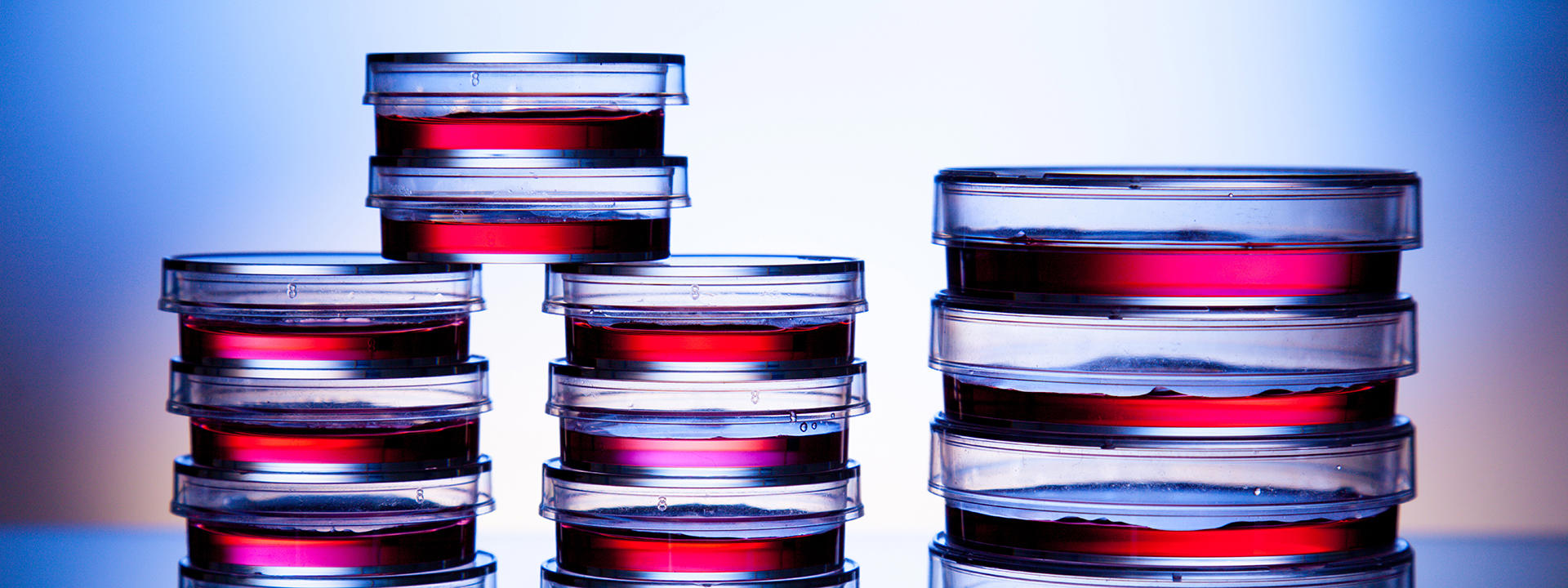 vattenanalys-samples-in-petri-dishes-in-laboratory_1920x720-px