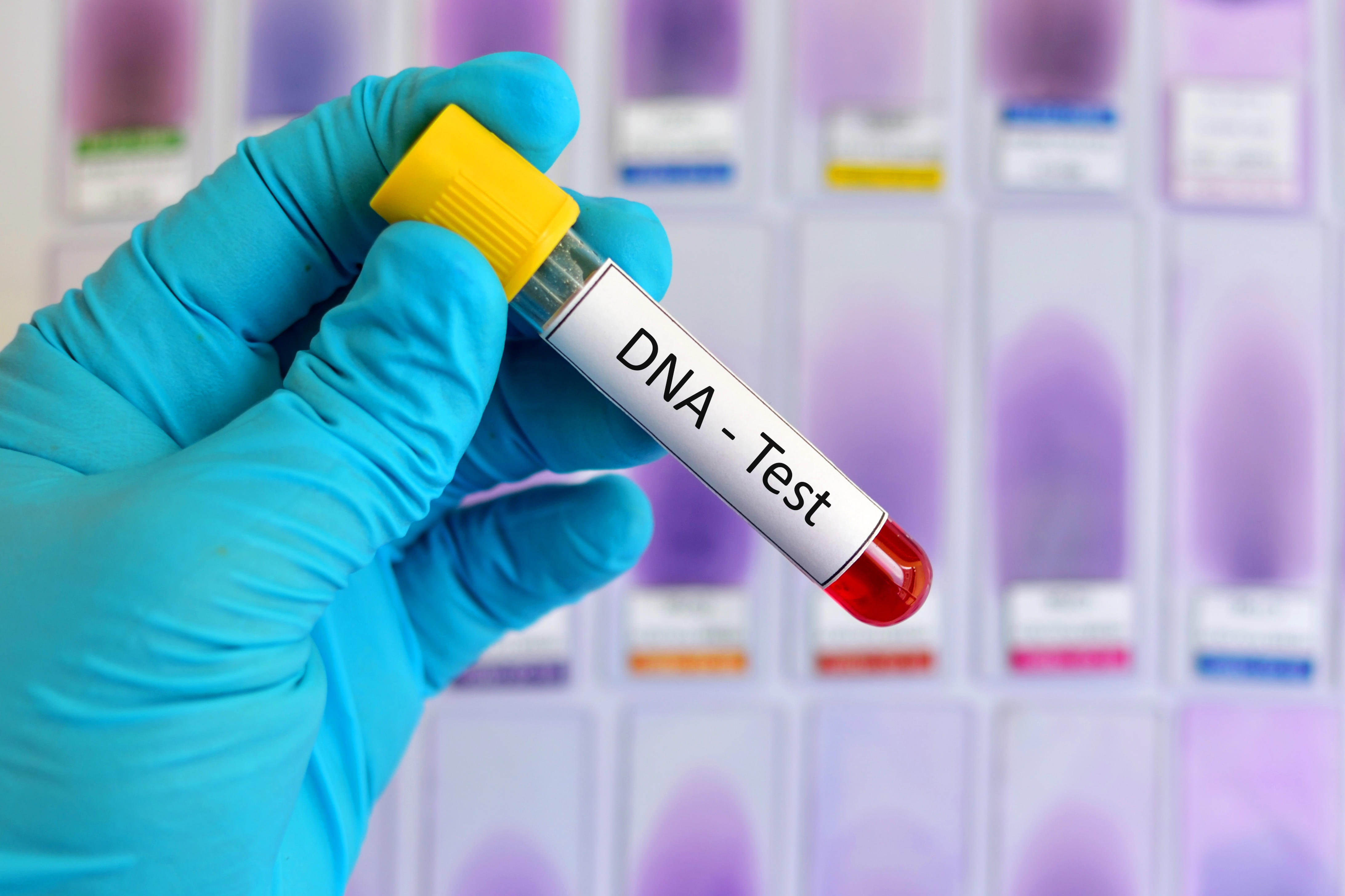 blood-sample-for-dna-testing-xl_4368x2911px