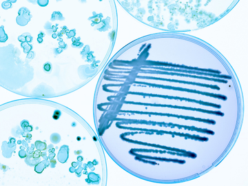 colony-forming-assay-cards