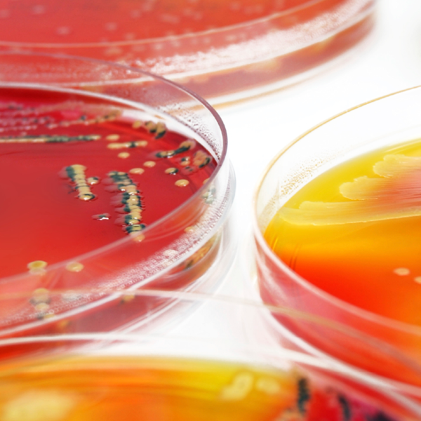 mikrobiologi-for-kvalitetsavdelingen