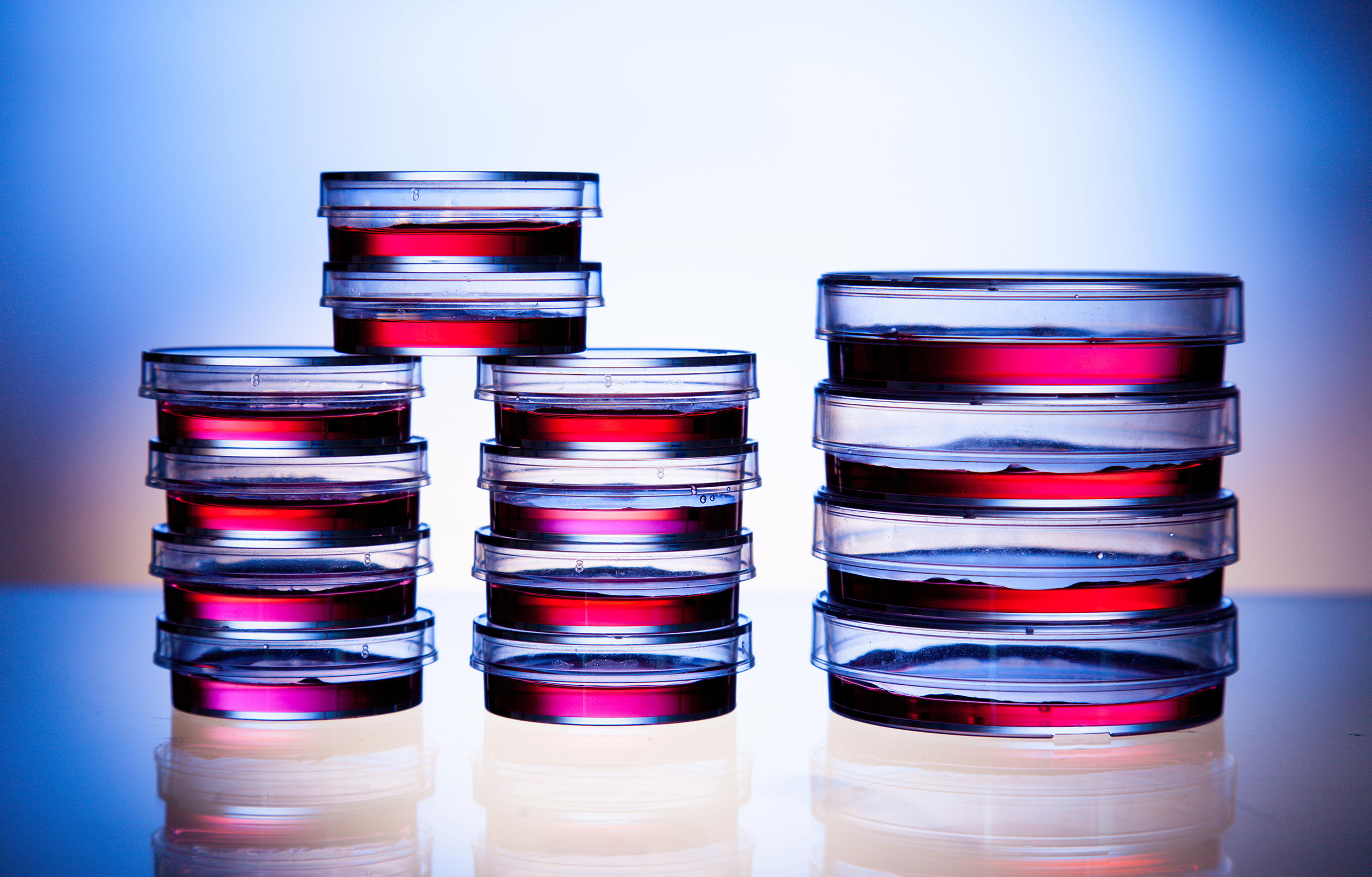 vattenanalys_-samples-in-petri-dishes-in-laboratory_72-dpi