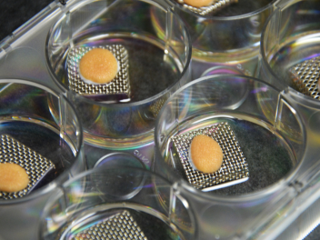 related-services-ex-vivo