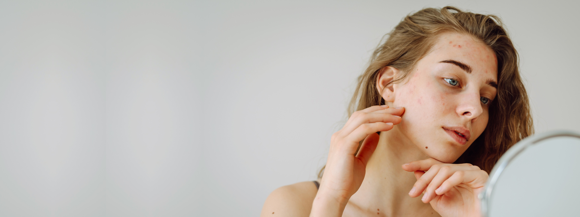 banner-website-sensitive-skin (1)