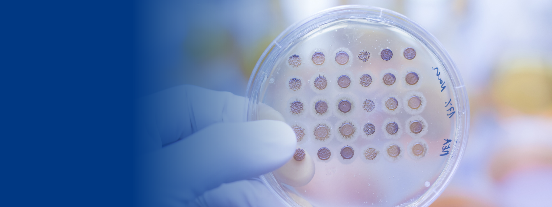 hprt-assay-website-banners