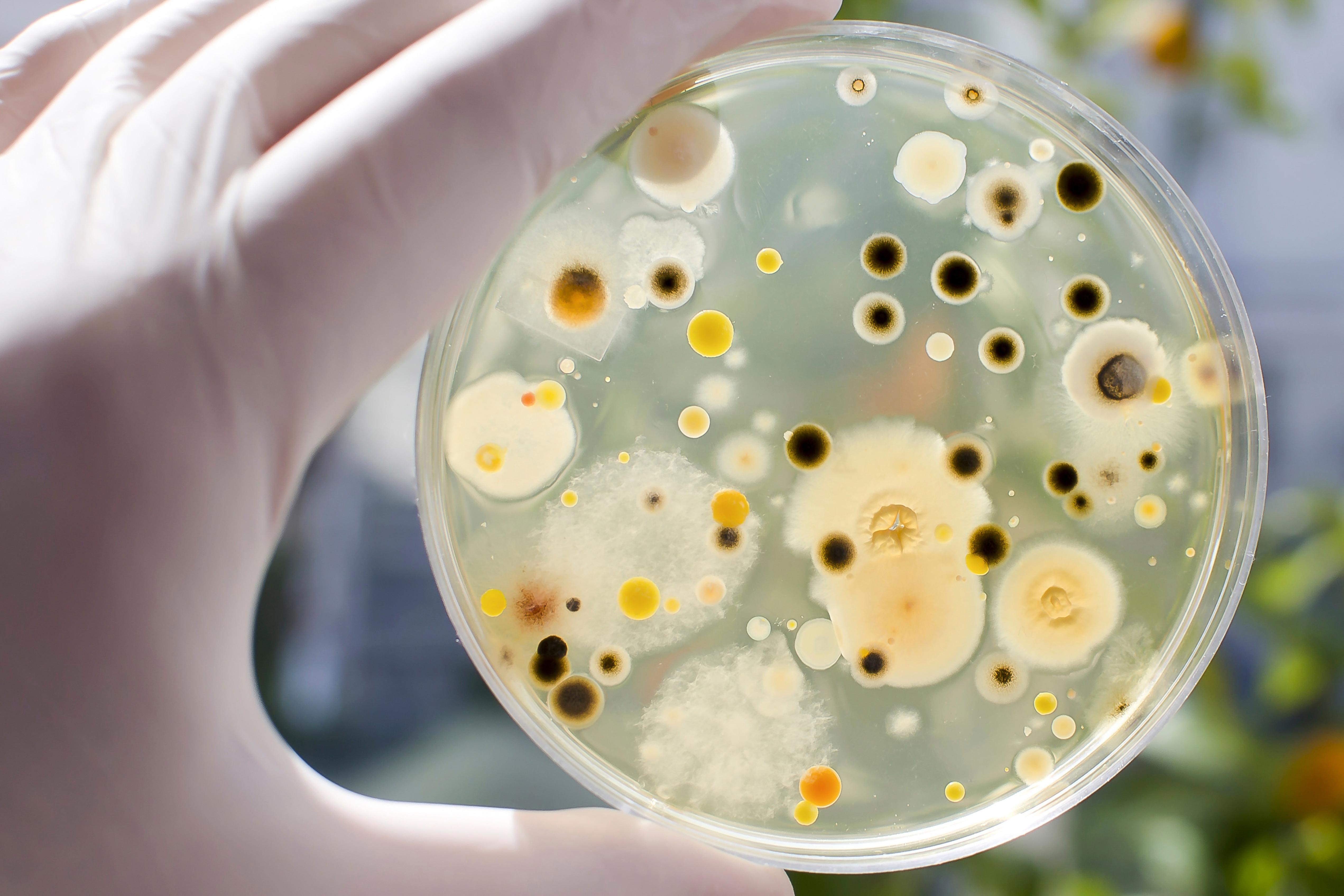 researcher-hand-in-glove-holding-petri-dish-with-colonies-of-different-bacteria-and-molds-on-natural-background-biotechnology-concept_5085-x-3390-px