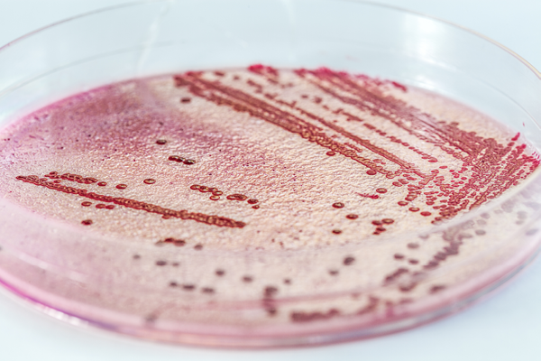 listeria2
