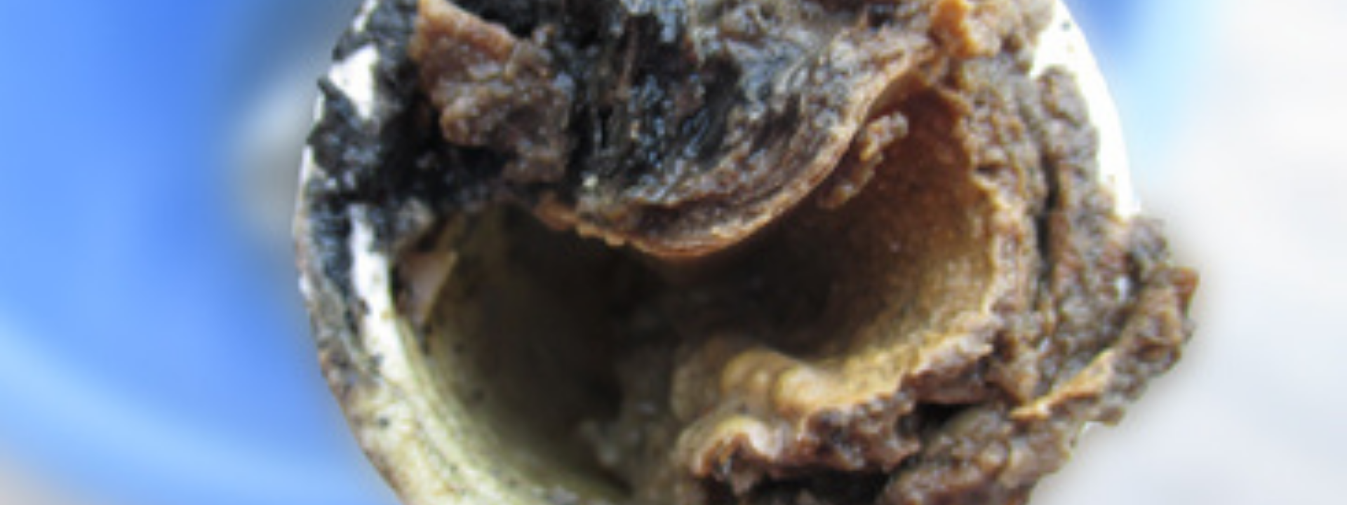 sielhautuntersuchungen_banner