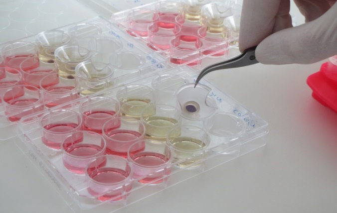 skin-irriation_md