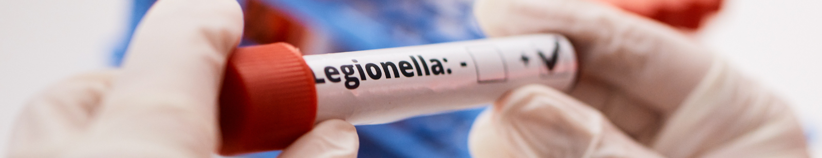 análisis-legionella-eurofins-environment-testing