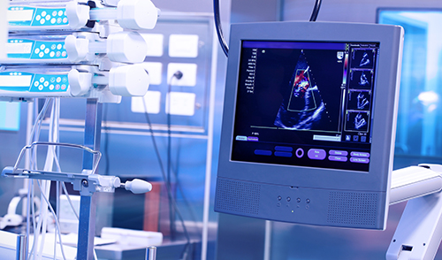 Écran d’échographie affichant une image en couleur du cœur, entouré de vignettes montrant différentes vues, dans une salle d’examen médical équipée de dispositifs connectés, illustrant les technologies de diagnostic utilisées chez Eurofins BioPharma Product Testing.